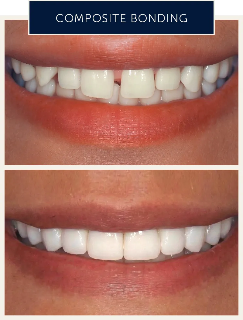 female-bonding-before-after