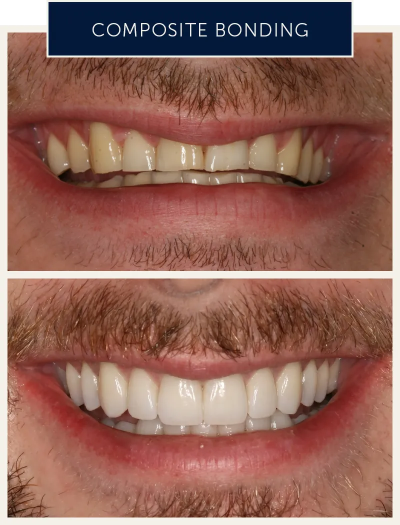male-bonding-before-after
